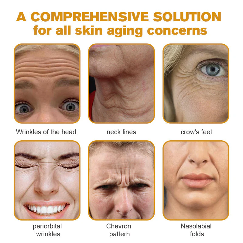👨‍⚕️👨‍⚕️ Made and Shipped from US✅ Botox Bee Venom Wrinkle Removal Cream- LAST DAY 80% OFF