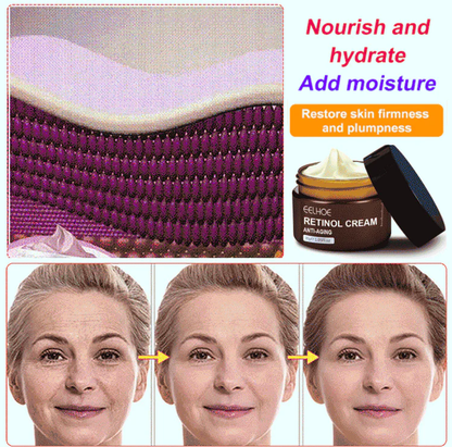 ✨Retinol Anti Aging Wrinkle Removal Skin Firming Cream