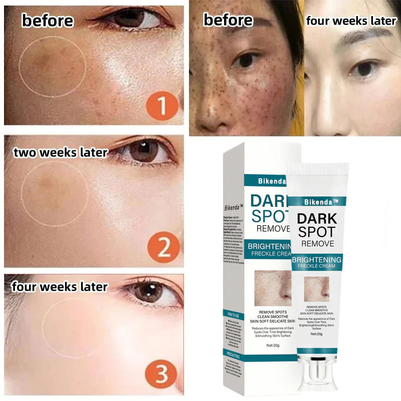 Bikenda™ Blemish Removing Beauty Cream – Fades Dark Spots, Freckles & Wrinkles | Age-Defying, Even-Tone Treatment