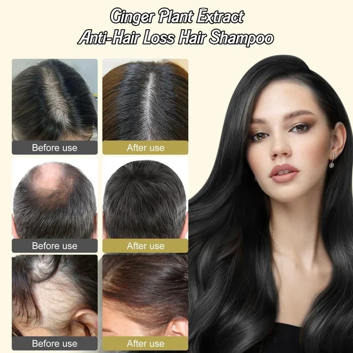 🙆‍♀️Anti-Hair Loss Hair Shampoo