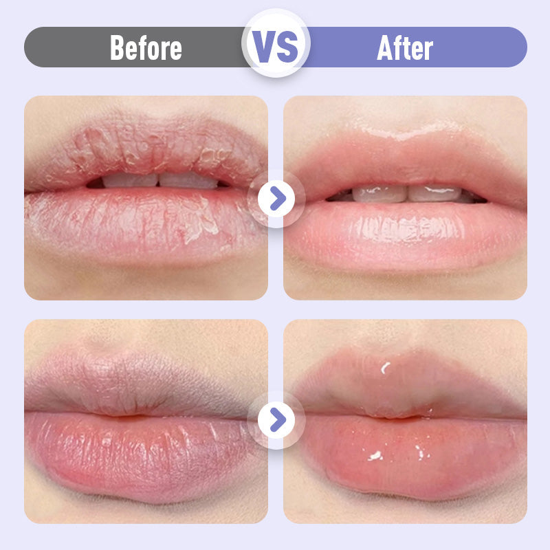 ✨Plumping and moisturizing lip serum against wrinkles