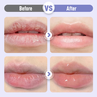 ✨Plumping and moisturizing lip serum against wrinkles