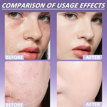 🔥Last Day-Buy 1 Get 1 Free!🎁Matte Concealer for Face & Body 1