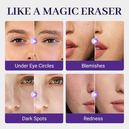 💜LAST DAY - BUY 1 GET 1 FREE💜Matte Concealer for Face & Body