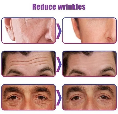 🏆Men's Anti-Aging Wrinkle Cream