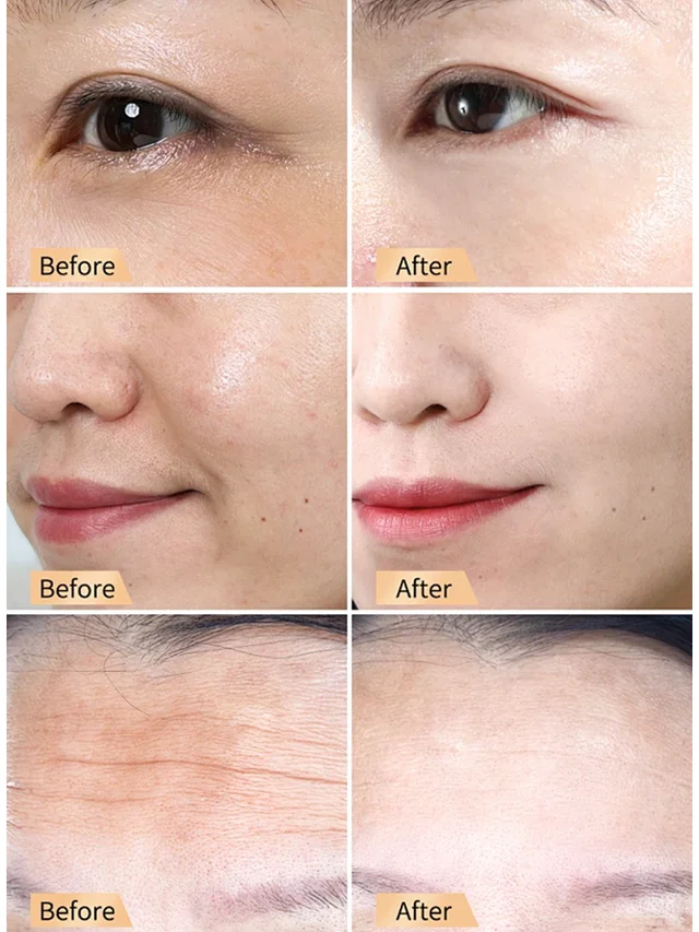 ✨🍯Snail Hydrating Anti-Wrinkle and Rejuvenating Cream