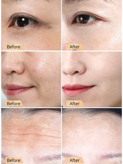 ✨🍯Snail Hydrating Anti-Wrinkle and Rejuvenating Cream