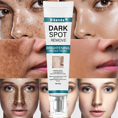 Bikenda™ Blemish Removing Beauty Cream – Fades Dark Spots, Freckles & Wrinkles | Age-Defying, Even-Tone Treatment