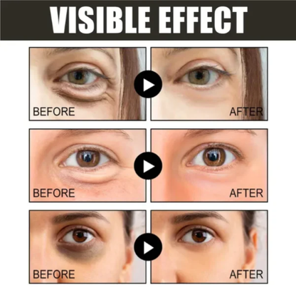 🔥 Retinol Caffeine Anti-Wrinkle Stay-Up Late Eye Cream 11 Reviews