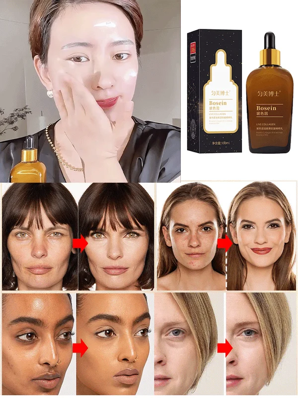 【Save Saggy Face】Dr. Yunmei's Boswellia Wrinkle-Resistant Essence