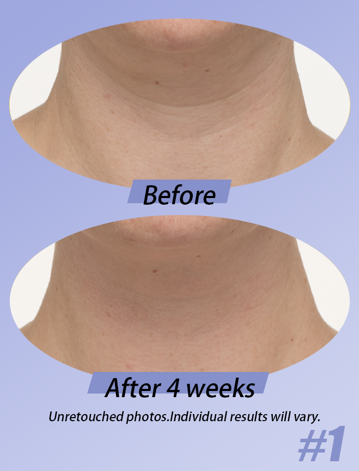 Neck Cream-Tighten & LiftFirming