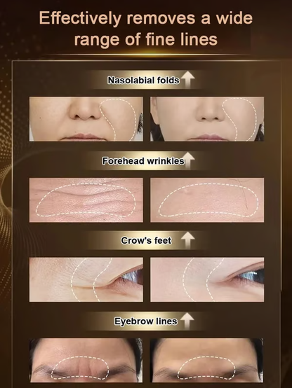 【Save Saggy Face】Dr. Yunmei's Boswellia Wrinkle-Resistant Essence