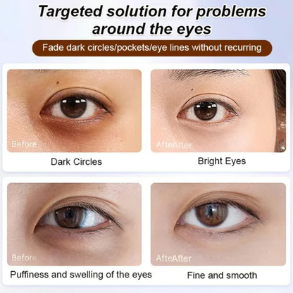 Dinkins Lutein Eye Essence Oil 🔥BUY 1 GET1 FREE🔥