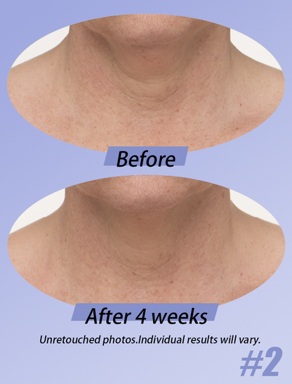 Neck Cream-Tighten & LiftFirming