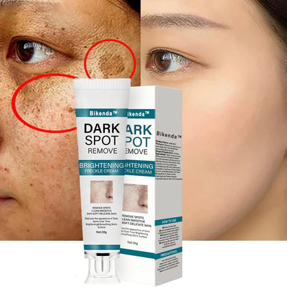 Bikenda™ Blemish Removing Beauty Cream – Fades Dark Spots, Freckles & Wrinkles | Age-Defying, Even-Tone Treatment