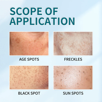 Bikenda™ Blemish Removing Beauty Cream – Fades Dark Spots, Freckles & Wrinkles | Age-Defying, Even-Tone Treatment