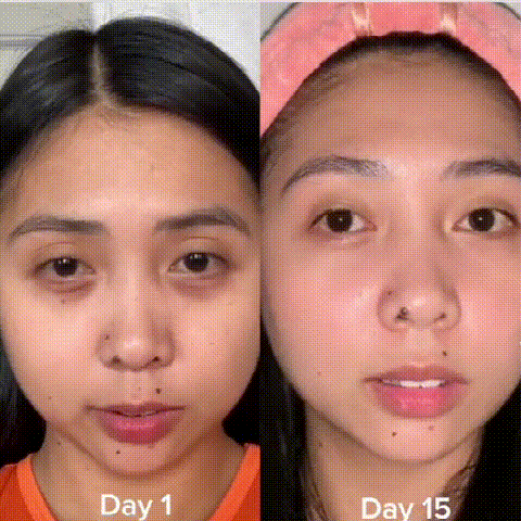 💥5D Peptide Anti-Wrinkle Eye Repair Cream