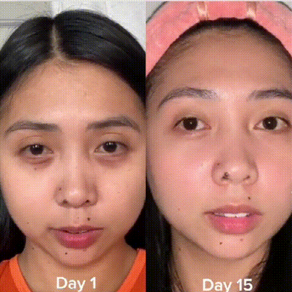 💥5D Peptide Anti-Wrinkle Eye Repair Cream